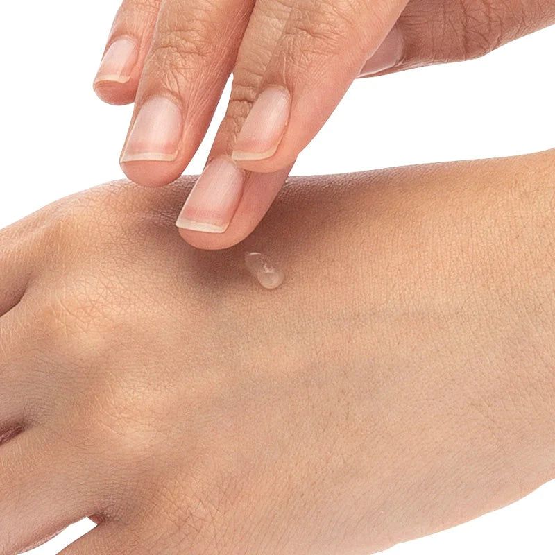 episof™ Soluție Avansată pentru Îngrijirea Pielii, Gel cu Silicon Pur pentru Repararea Vergeturilor, 30ml, Biodermis