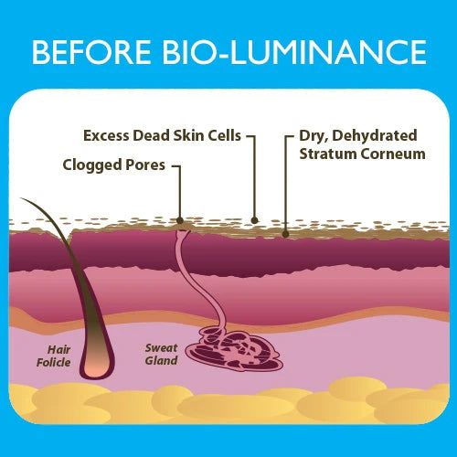 Masca de Hidroterapie cu Silicon, BIO-luminance, Biodermis